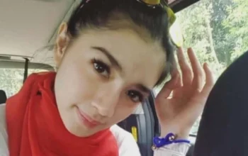 Terbongkar! Rahasia Kecantikan Baru Angel Karamoy, Netizen: “Cantik Tapi…”